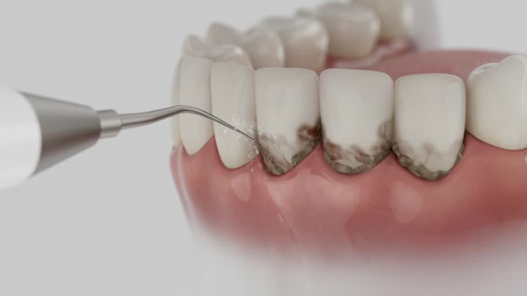 Reliable Wisdom Tooth Removal contractor in Chippewa County County, MI by Dentist Open Now